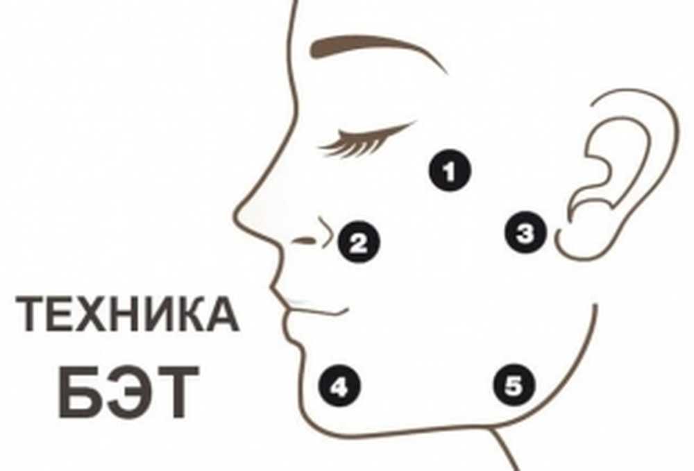 Профайл схемы. Техника введения профайло. Схема введения препарата профайло. Схема профайла лицо. Биологические активные точки на лице.