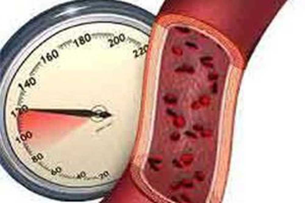 stupanj ozbiljnosti bolesti hipertenzije