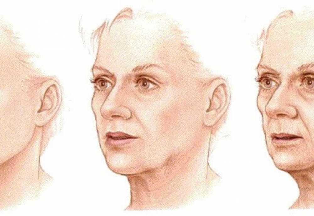 Ageing добавить. Возрастные изменения кожи лица. Возрастные изменения овала лица. Возраст к лицу. Старение человека.