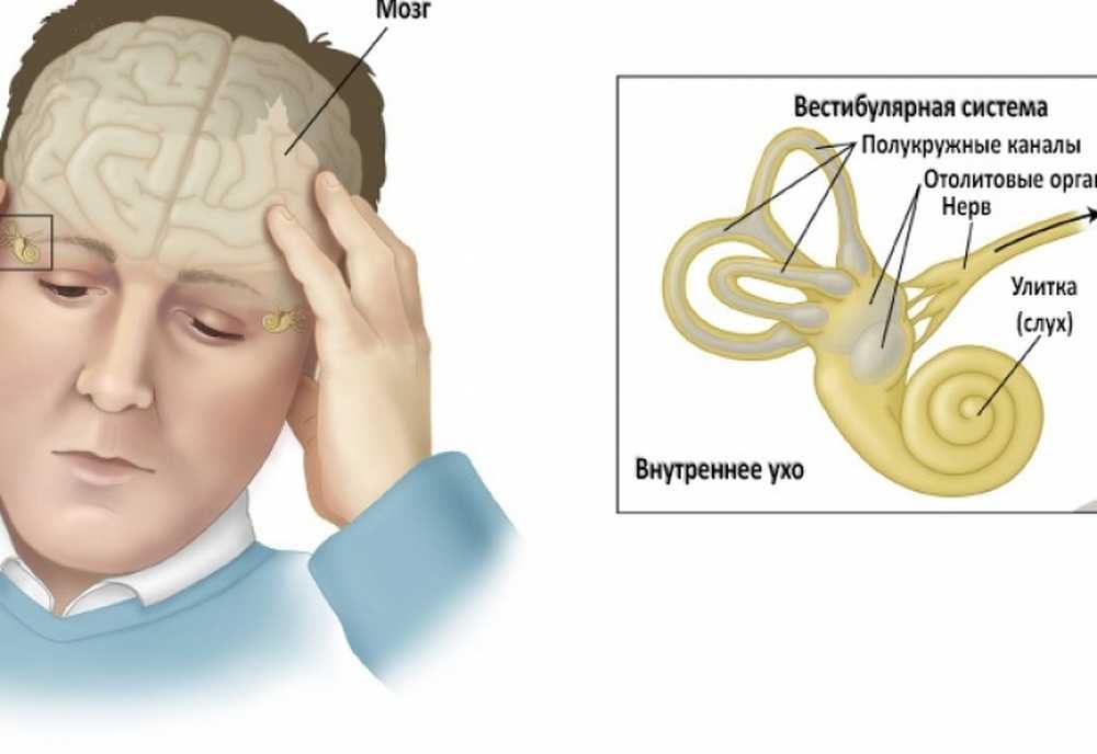 Нарушение вестибулярного аппарата с возрастом. Вестибулярный аппарат нарушения. Нарушение вестибулярного аппарата симптомы. Нарушение вестибулярного аппа. Патологии вестибулярного аппарата.