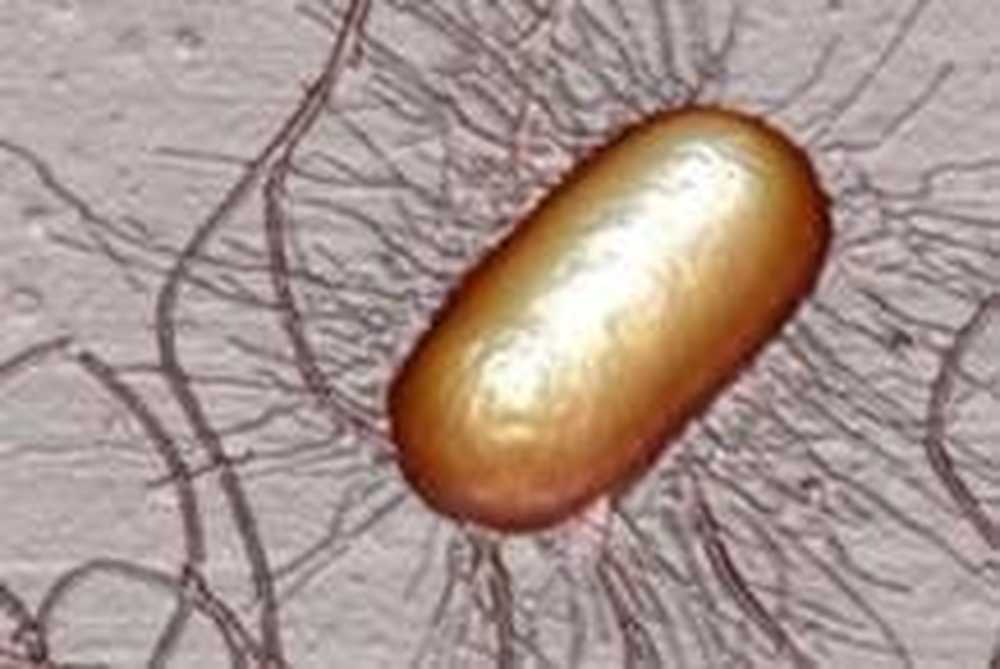 Escherichia coli лактозонегативная