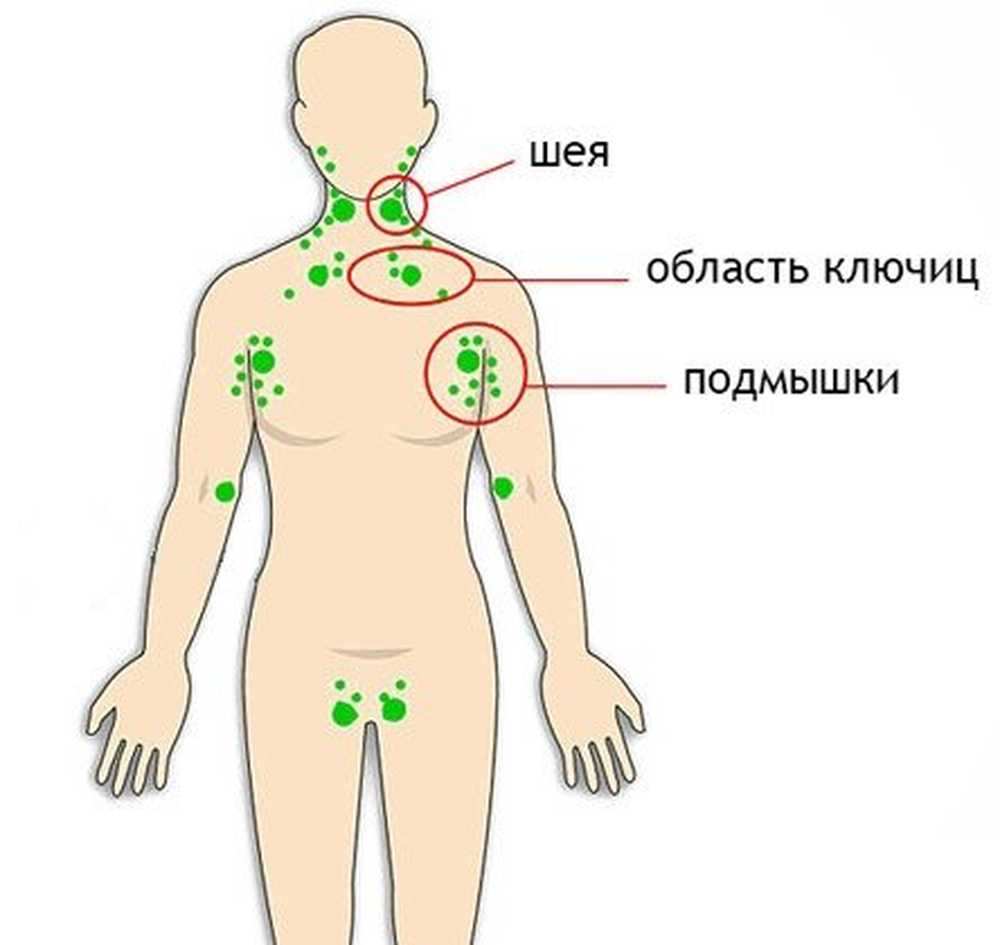 Лимфатические узлы на теле человека схема