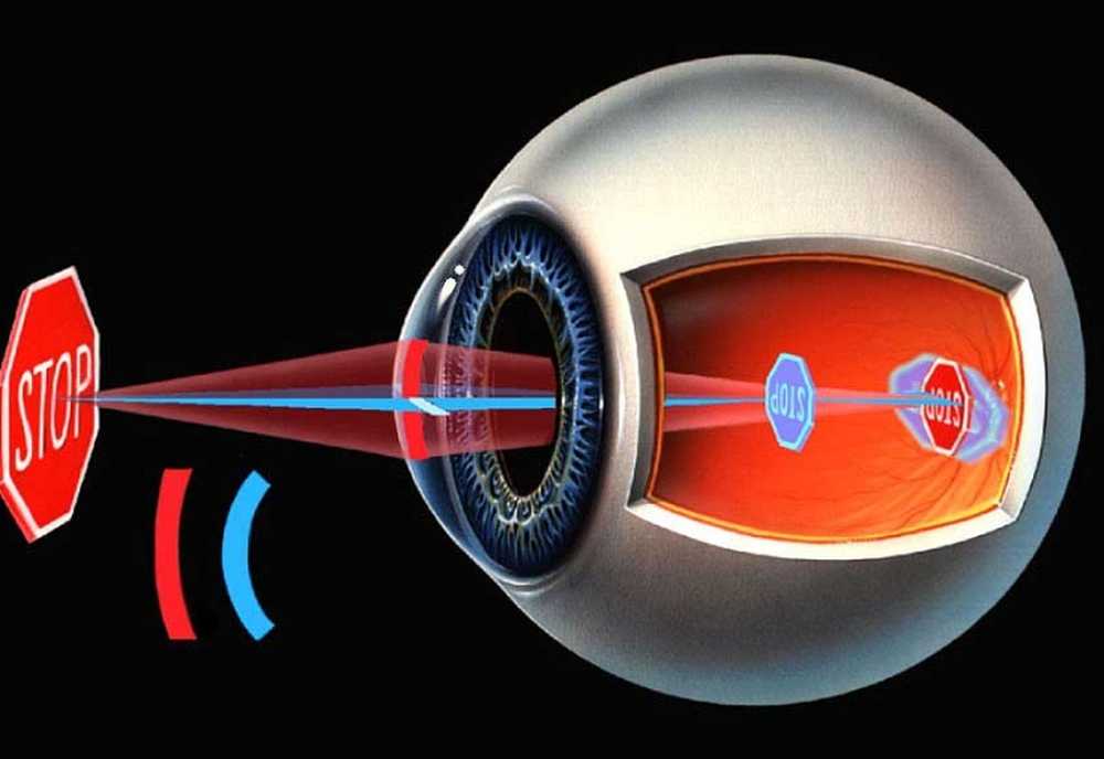 Astigmatism. Астигматизм сетчатки глаза. Роговичный астигматизм. Хрусталиковый астигматизм. Роговичный и хрусталиковый астигматизм.