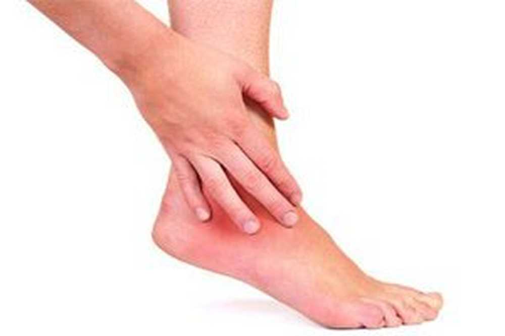 deformirajuća artroza 1. stupnja liječenja zgloba gležnja bol u zglobu gležnja s groznicom