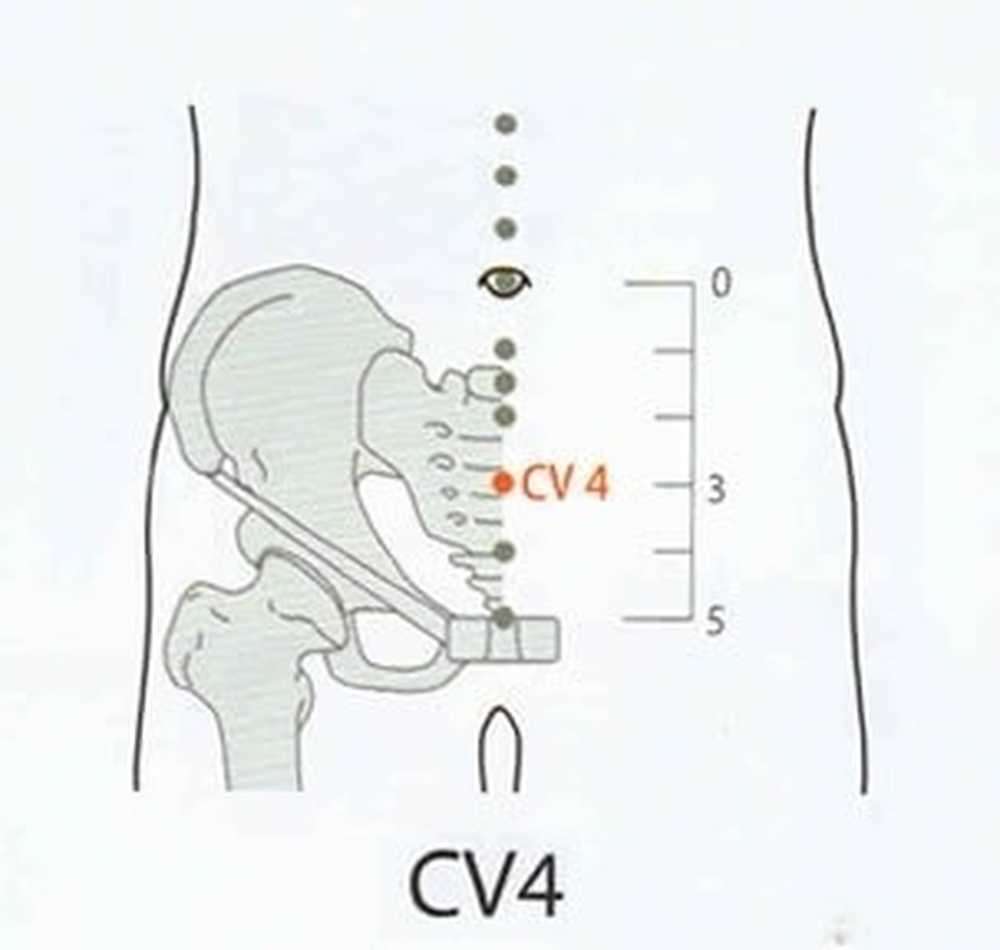 Универсальная точка. Гуань юань точка для похудения. Точка cv4. Точка Гуань-юань для похудения где. Ши Мэнь точка.